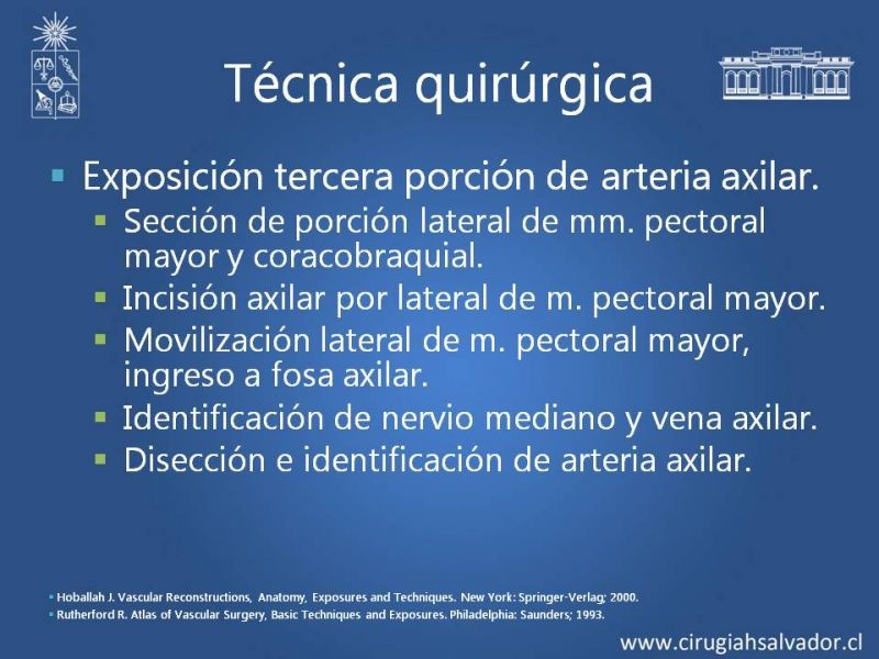 Diapositiva 9 de Anatomía quirúrgica y accesos vasculares: Arteria axilar, braquial, radial y ulnar