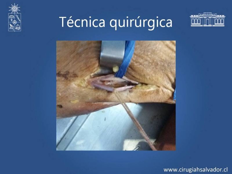 Diapositiva 14 de Anatomía quirúrgica y accesos vasculares: Arteria axilar, braquial, radial y ulnar