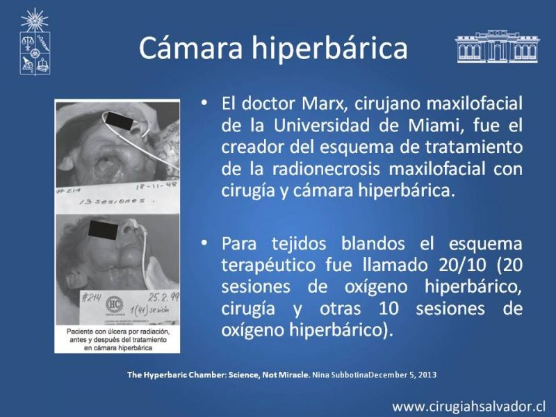Diapositiva 22 de Úlceras por radionecrosis