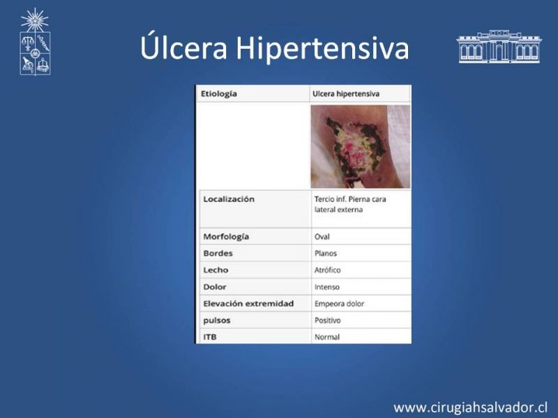 Diapositiva 21 de Úlceras de EEII: Diagnóstico diferencial y tratamiento