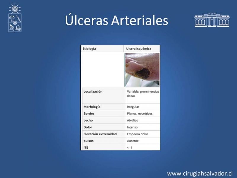 Diapositiva 20 de Úlceras de EEII: Diagnóstico diferencial y tratamiento