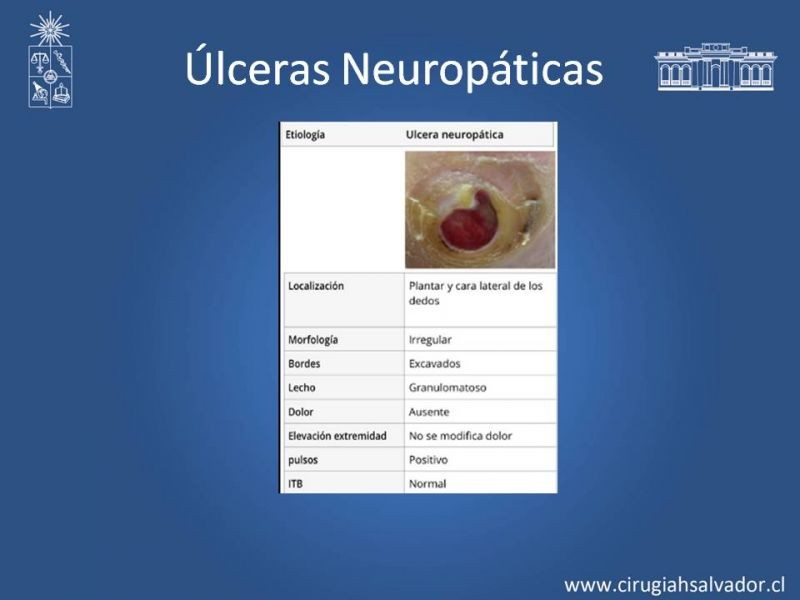 Diapositiva 23 de Úlceras de EEII: Diagnóstico diferencial y tratamiento
