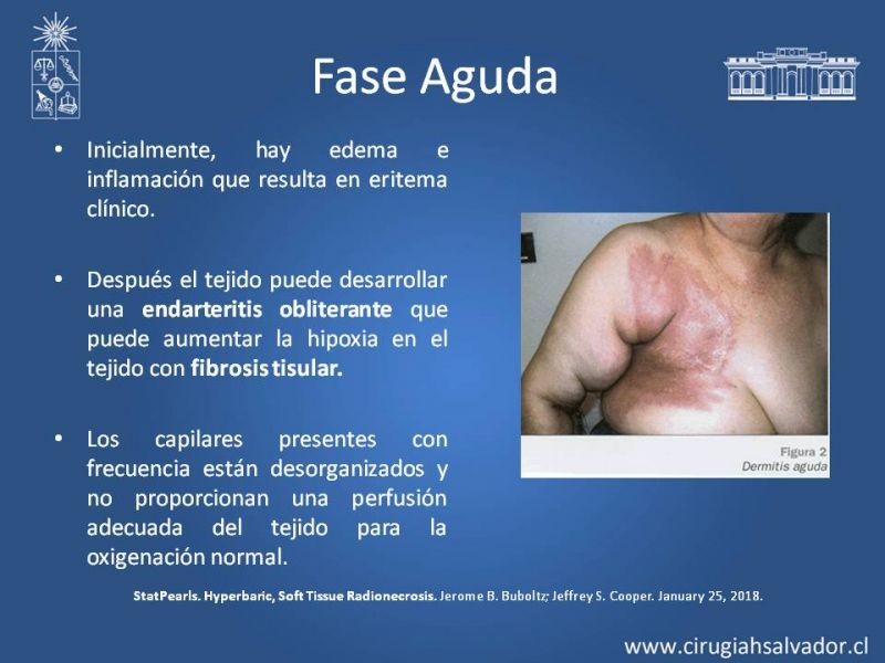 Diapositiva 7 de Úlceras por radionecrosis