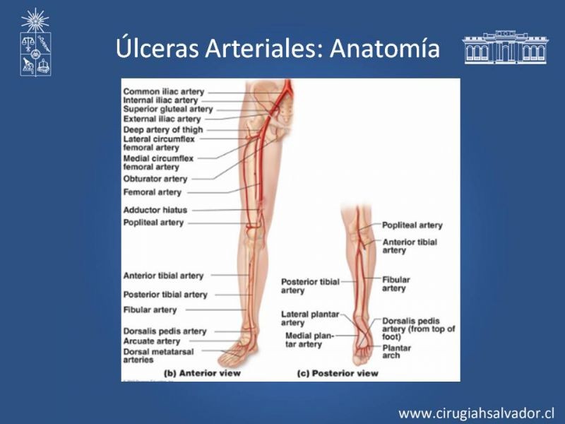 Diapositiva 18 de Úlceras de EEII: Diagnóstico diferencial y tratamiento