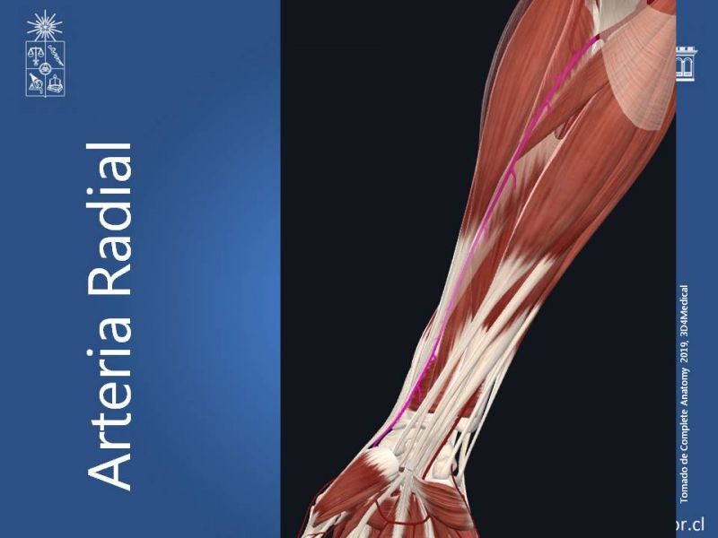Diapositiva 17 de Anatomía quirúrgica y accesos vasculares: Arteria axilar, braquial, radial y ulnar