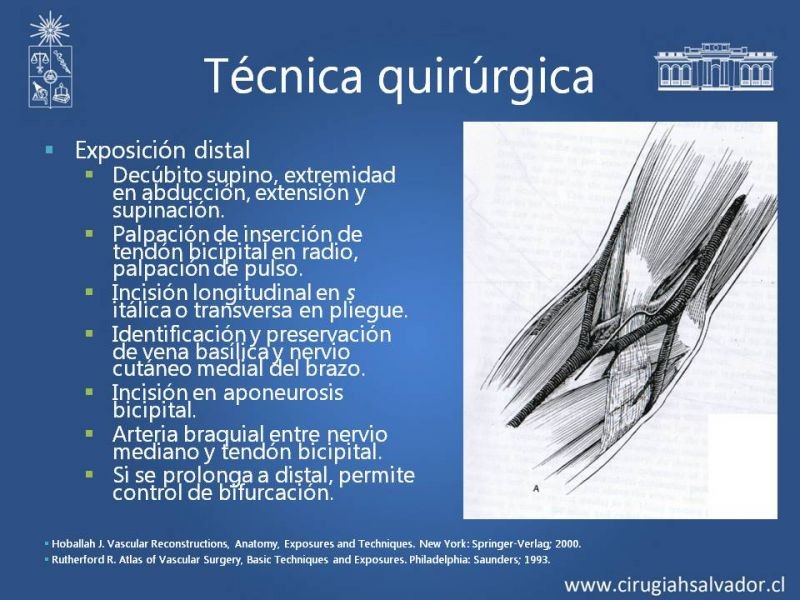 Diapositiva 15 de Anatomía quirúrgica y accesos vasculares: Arteria axilar, braquial, radial y ulnar