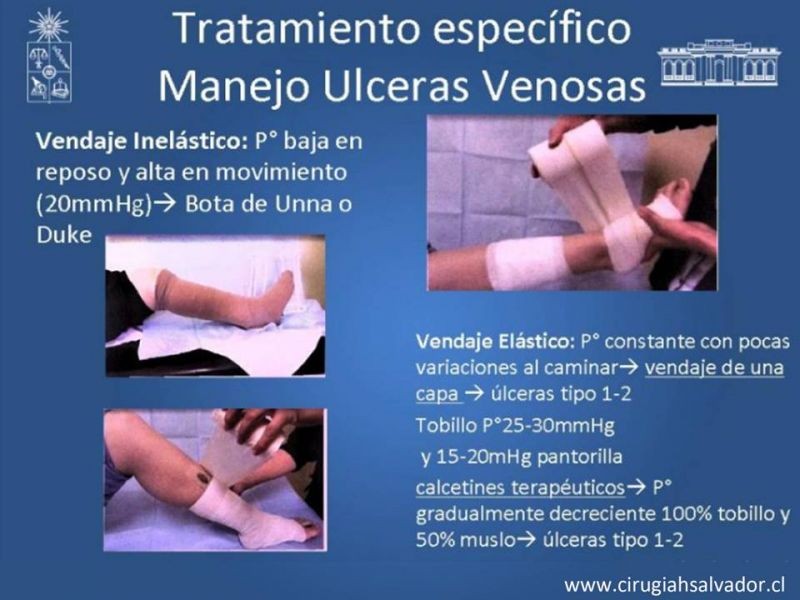 Diapositiva 35 de Úlceras de EEII: Diagnóstico diferencial y tratamiento