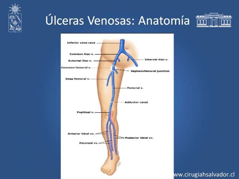 Diapositiva 7 de Úlceras de EEII: Diagnóstico diferencial y tratamiento