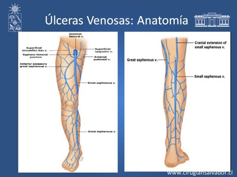 Diapositiva 8 de Úlceras de EEII: Diagnóstico diferencial y tratamiento