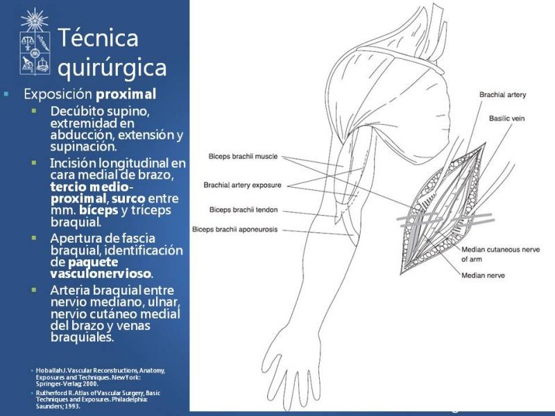 Diapositiva 12 de Anatomía quirúrgica y accesos vasculares: Arteria axilar, braquial, radial y ulnar
