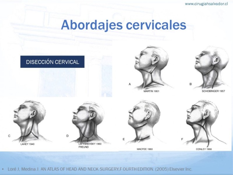 Diapositiva 22 de Anatomía quirúrgica de cuello