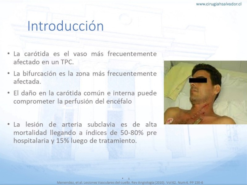 Diapositiva 2 de Anatomía quirúrgica y accesos quirúrgicos carotideo y subclavio