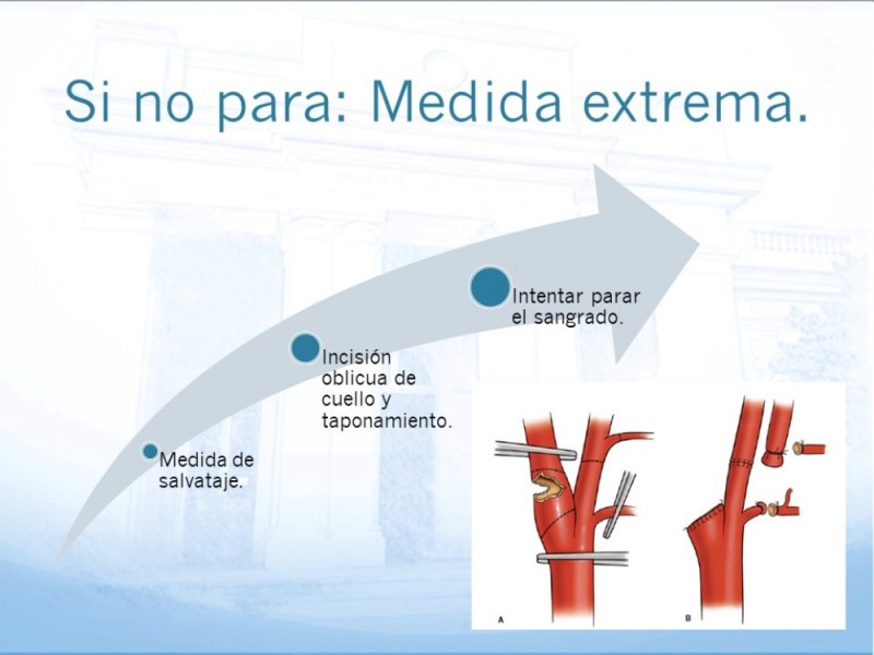 Diapositiva 24 de Trauma Cervical