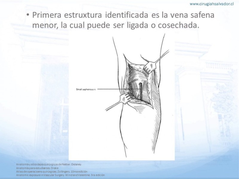 Diapositiva 17 de Anatomía quirúrgica y accesos quirúrgicos femoral y poplíteo