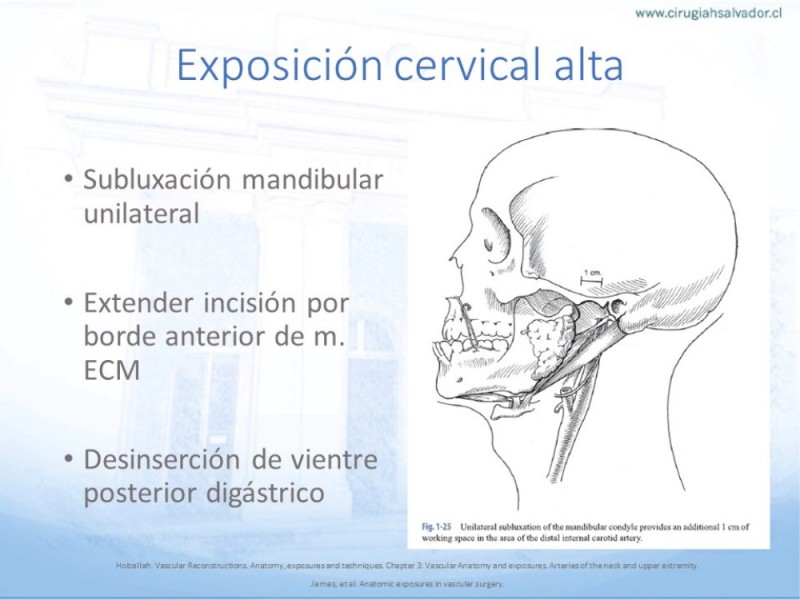 Diapositiva 14 de Anatomía quirúrgica y accesos quirúrgicos carotideo y subclavio