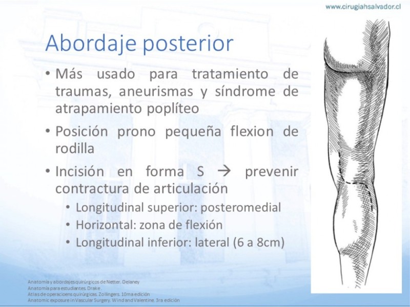 Diapositiva 16 de Anatomía quirúrgica y accesos quirúrgicos femoral y poplíteo