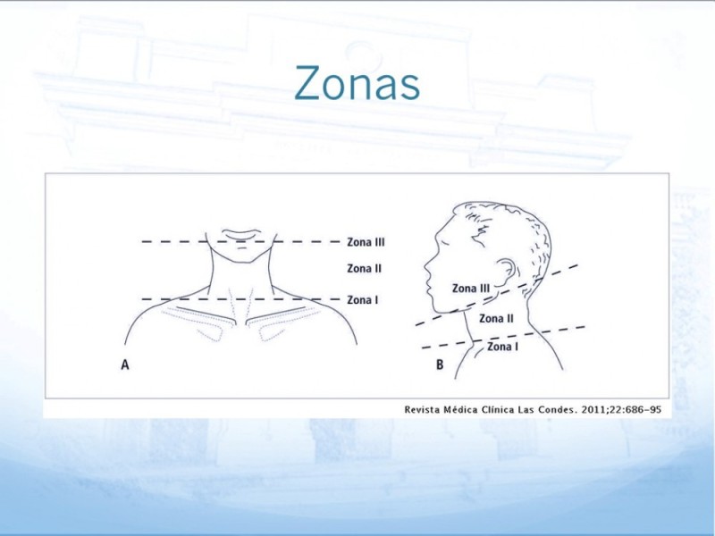 Diapositiva 8 de Trauma Cervical