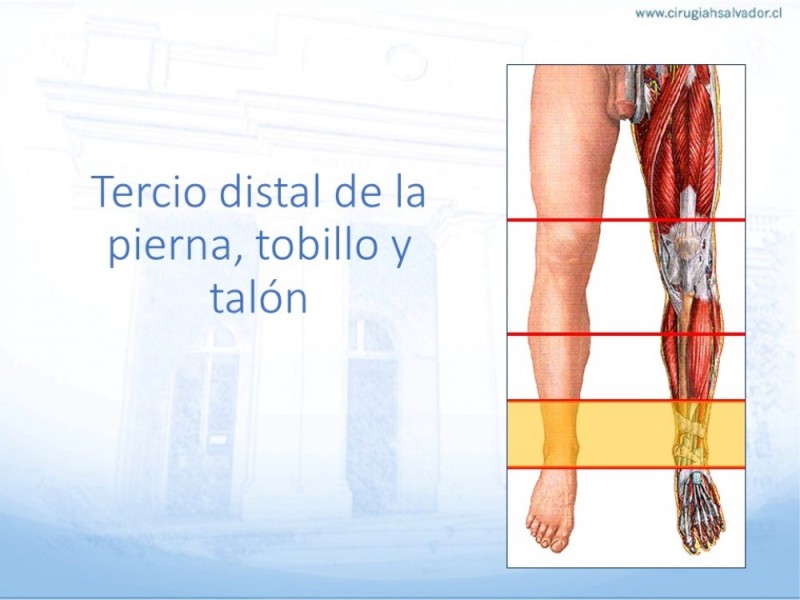 Diapositiva 42 de Cobertura de Extremidades Inferiores