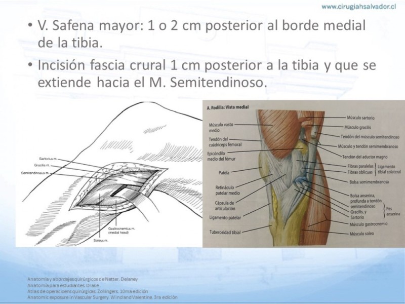 Diapositiva 25 de Anatomía quirúrgica y accesos quirúrgicos femoral y poplíteo