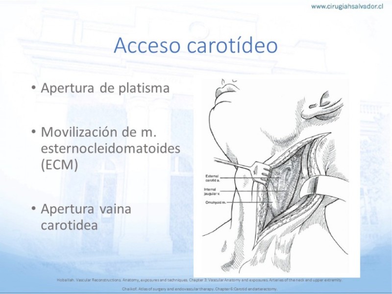 Diapositiva 10 de Anatomía quirúrgica y accesos quirúrgicos carotideo y subclavio