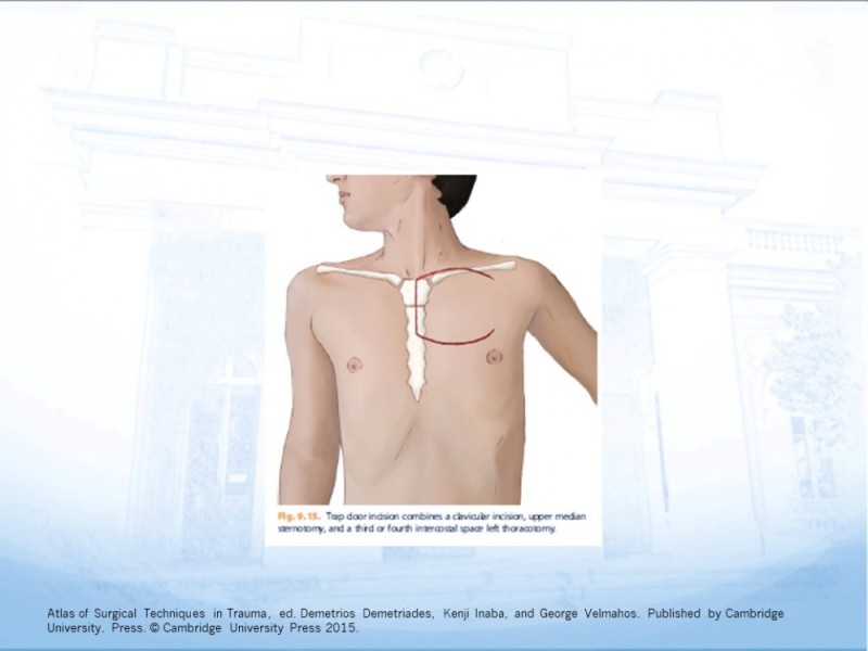 Diapositiva 45 de Trauma Cervical
