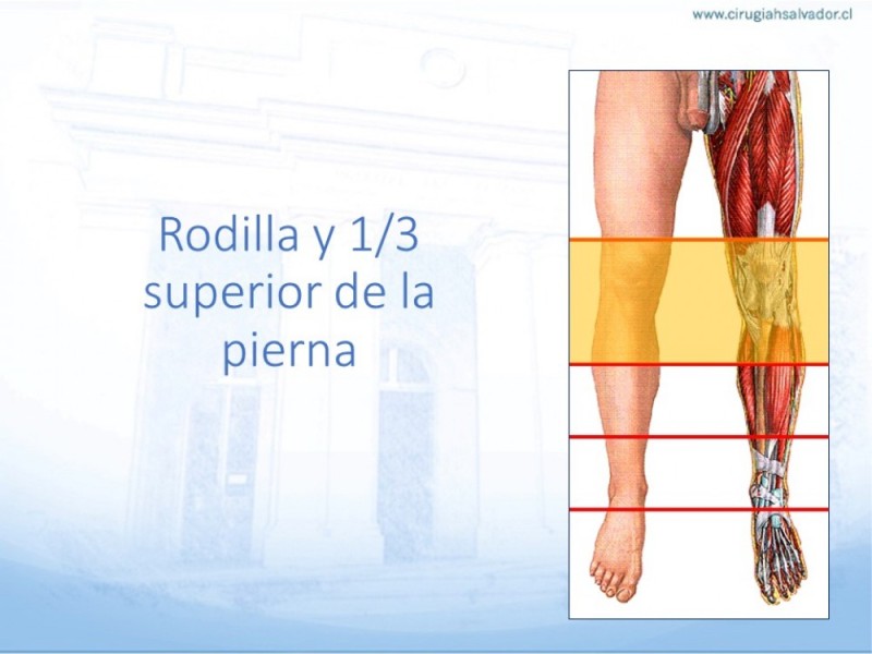 Diapositiva 29 de Cobertura de Extremidades Inferiores