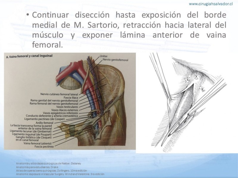 Diapositiva 10 de Anatomía quirúrgica y accesos quirúrgicos femoral y poplíteo