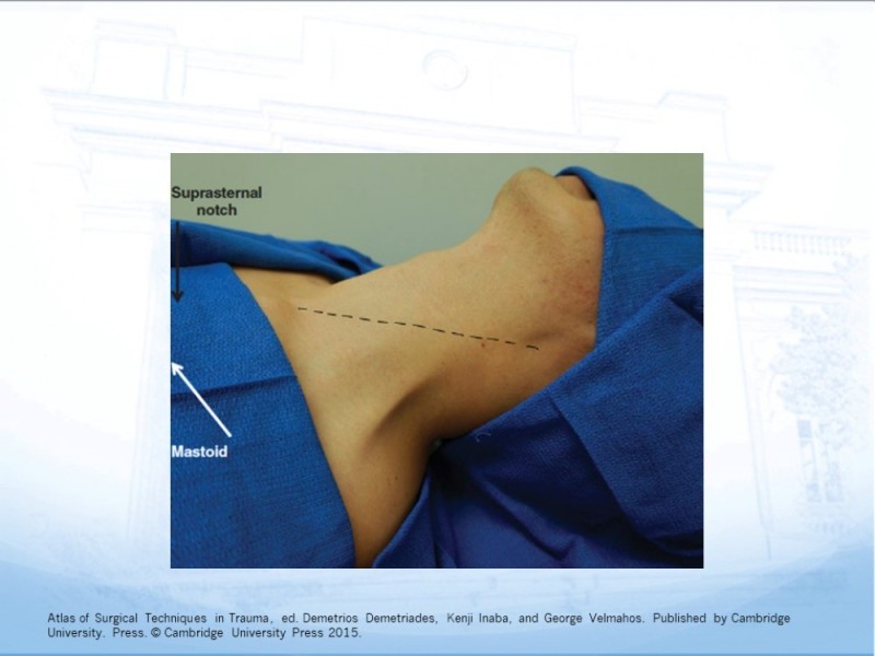 Diapositiva 40 de Trauma Cervical