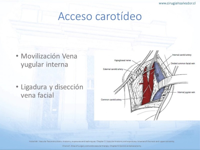 Diapositiva 11 de Anatomía quirúrgica y accesos quirúrgicos carotideo y subclavio