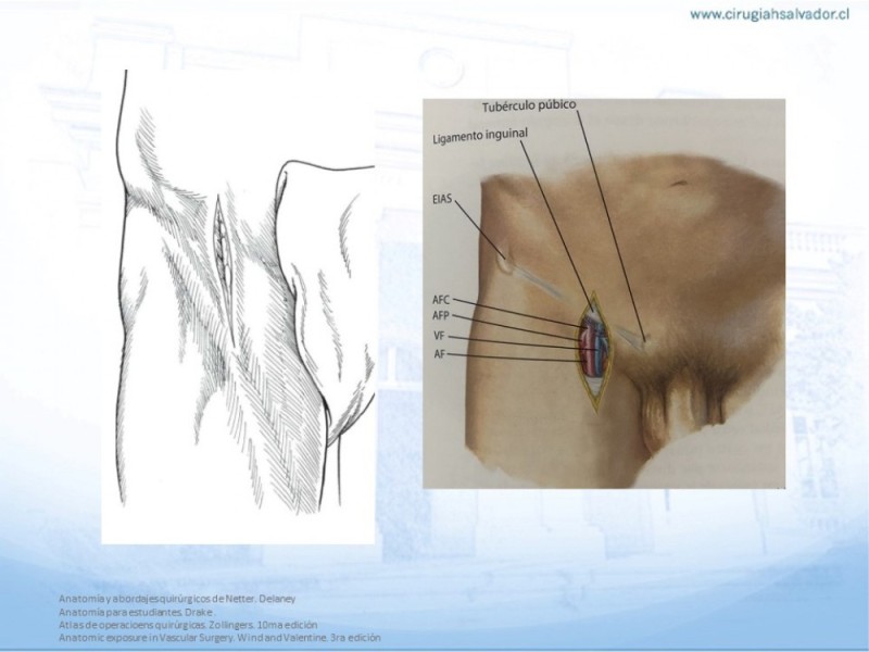Diapositiva 5 de Anatomía quirúrgica y accesos quirúrgicos femoral y poplíteo