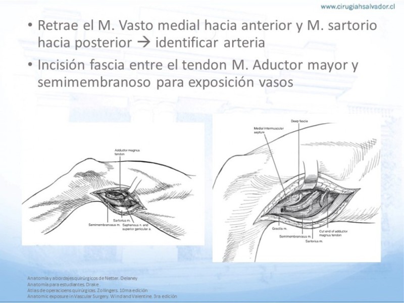 Diapositiva 22 de Anatomía quirúrgica y accesos quirúrgicos femoral y poplíteo