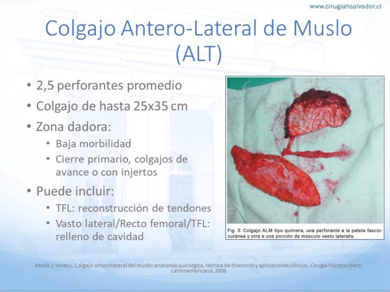 Diapositiva 25 de Cobertura de Extremidades Inferiores