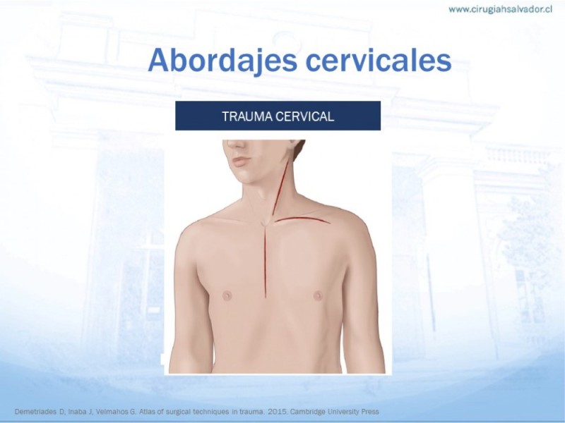 Diapositiva 24 de Anatomía quirúrgica de cuello