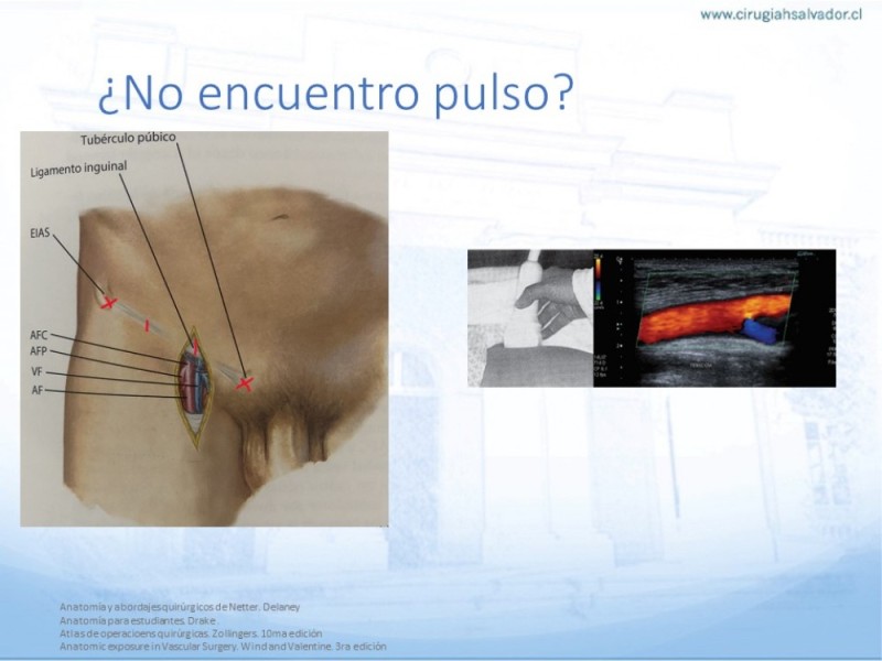 Diapositiva 6 de Anatomía quirúrgica y accesos quirúrgicos femoral y poplíteo
