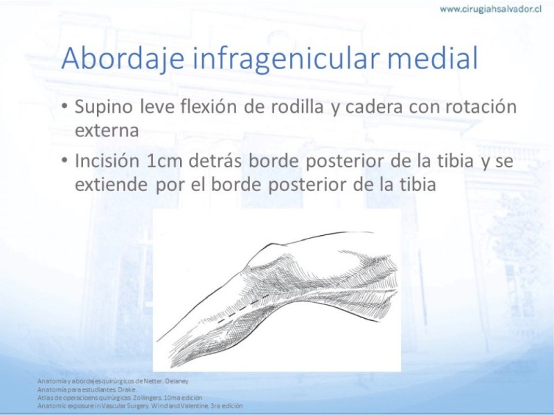 Diapositiva 24 de Anatomía quirúrgica y accesos quirúrgicos femoral y poplíteo