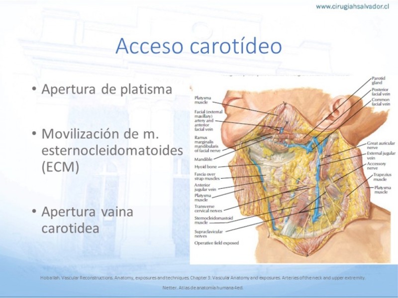 Diapositiva 9 de Anatomía quirúrgica y accesos quirúrgicos carotideo y subclavio