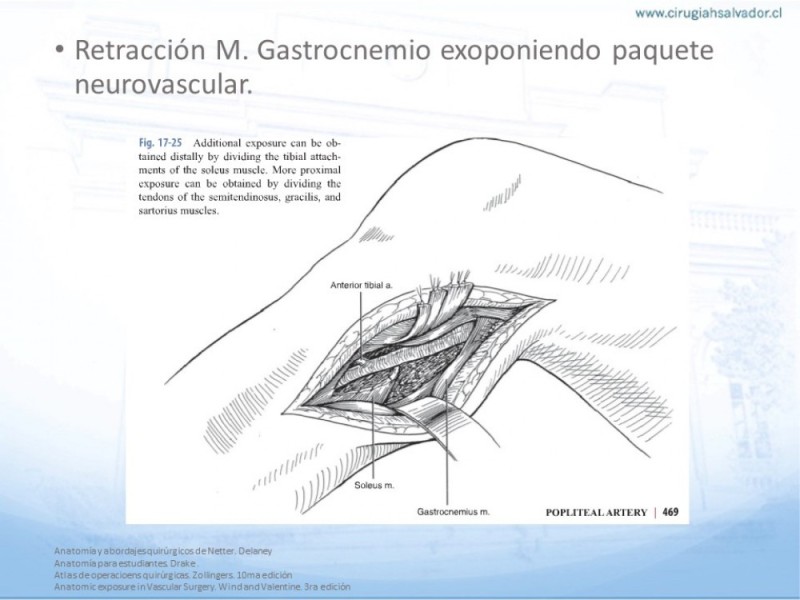 Diapositiva 26 de Anatomía quirúrgica y accesos quirúrgicos femoral y poplíteo