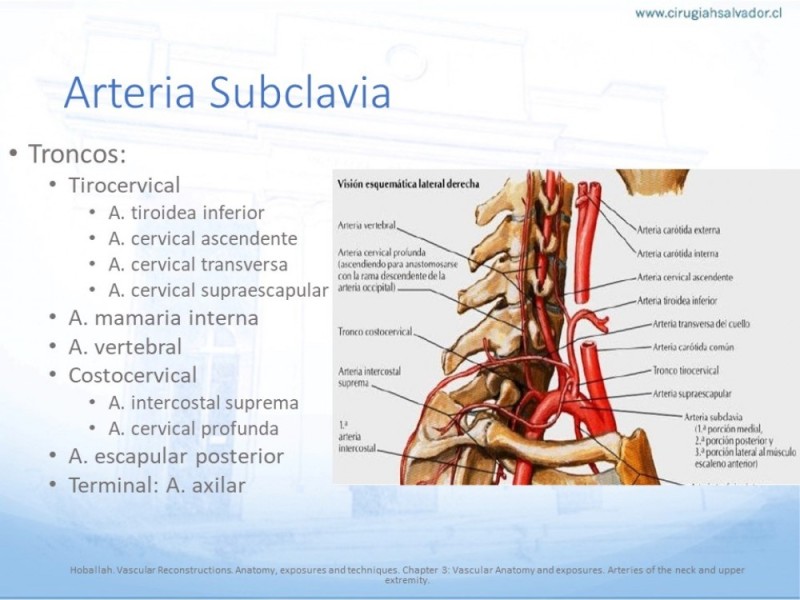Diapositiva 17 de Anatomía quirúrgica y accesos quirúrgicos carotideo y subclavio