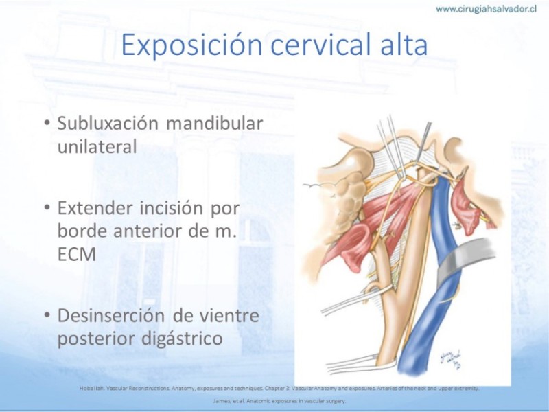 Diapositiva 15 de Anatomía quirúrgica y accesos quirúrgicos carotideo y subclavio