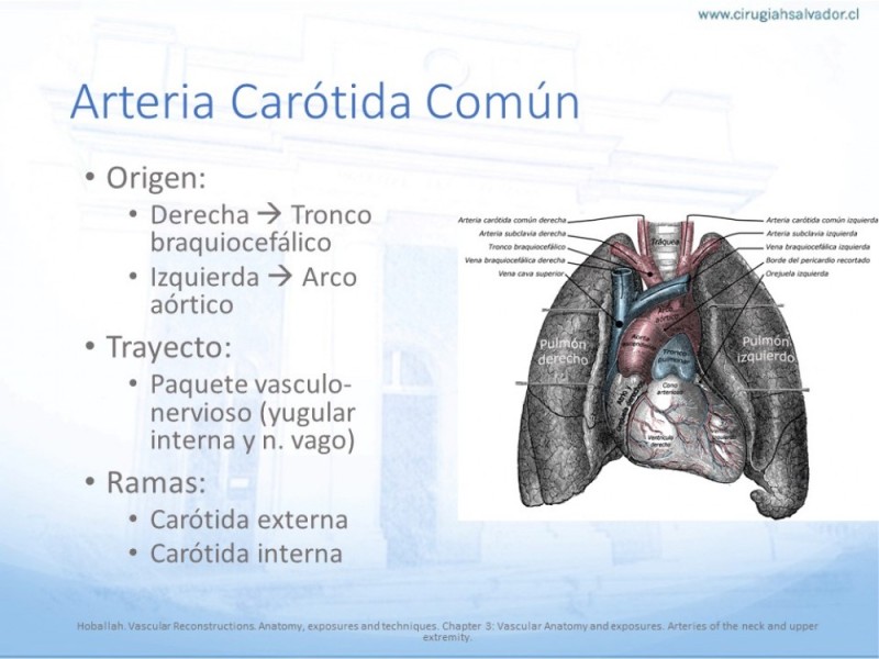 Diapositiva 3 de Anatomía quirúrgica y accesos quirúrgicos carotideo y subclavio