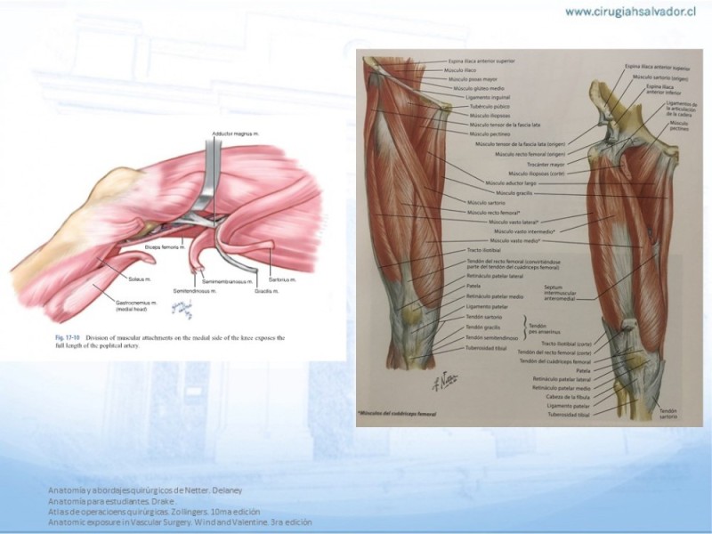 Diapositiva 21 de Anatomía quirúrgica y accesos quirúrgicos femoral y poplíteo