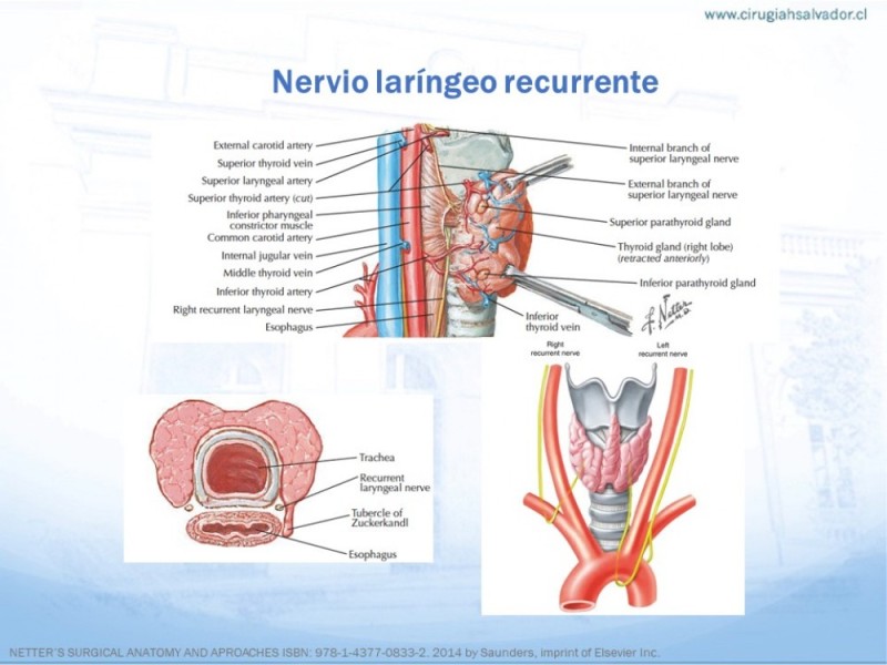Diapositiva 15 de Anatomía quirúrgica de cuello