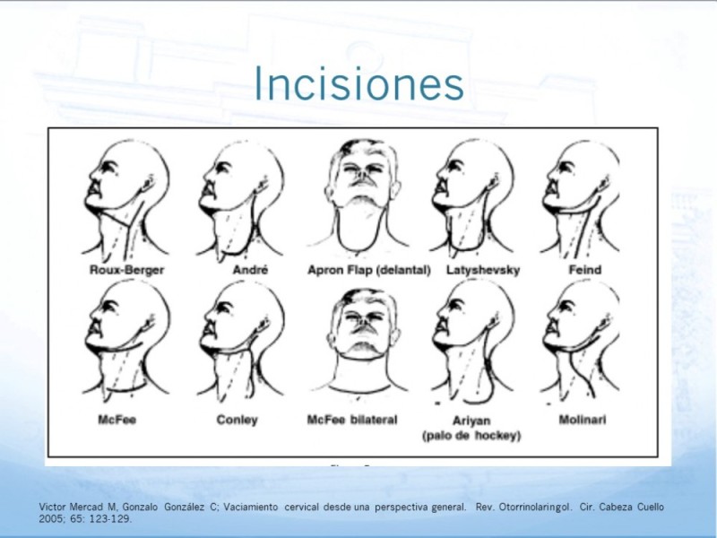 Diapositiva 41 de Trauma Cervical