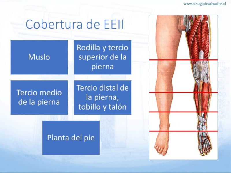 Diapositiva 21 de Cobertura de Extremidades Inferiores