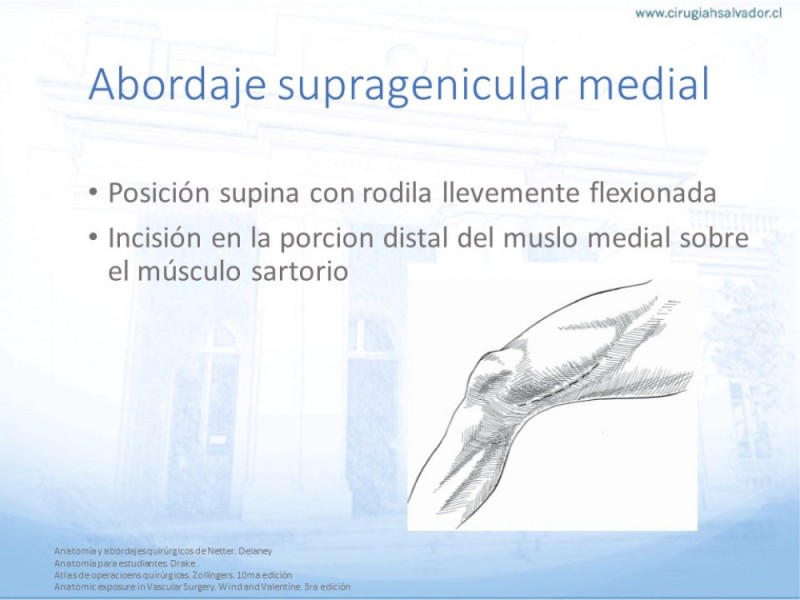 Diapositiva 20 de Anatomía quirúrgica y accesos quirúrgicos femoral y poplíteo