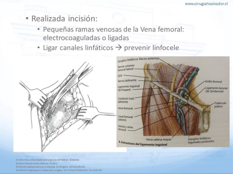 Diapositiva 9 de Anatomía quirúrgica y accesos quirúrgicos femoral y poplíteo
