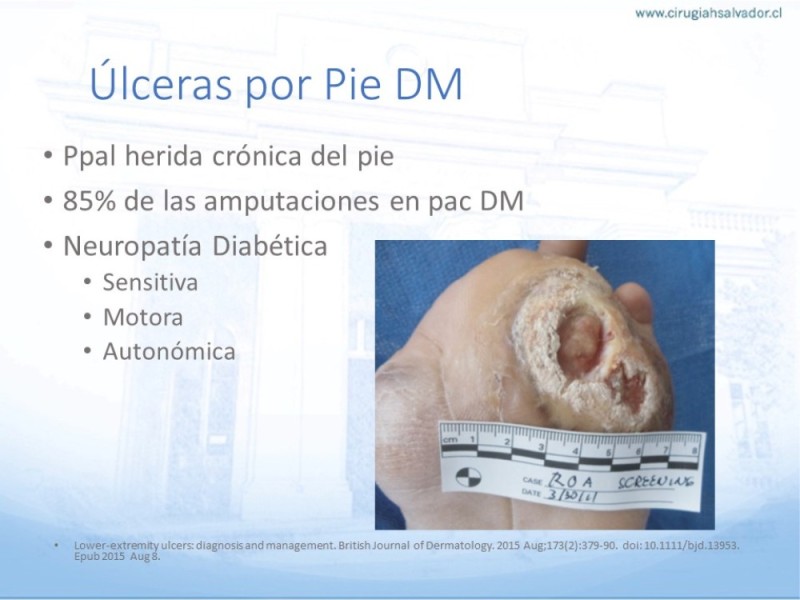 Diapositiva 10 de Enfrentamiento Úlceras EEII