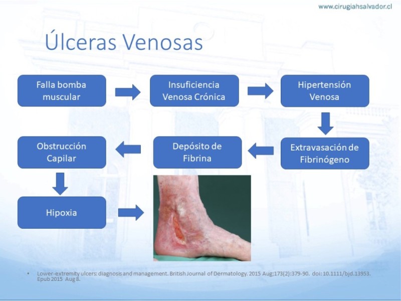 Diapositiva 3 de Enfrentamiento Úlceras EEII