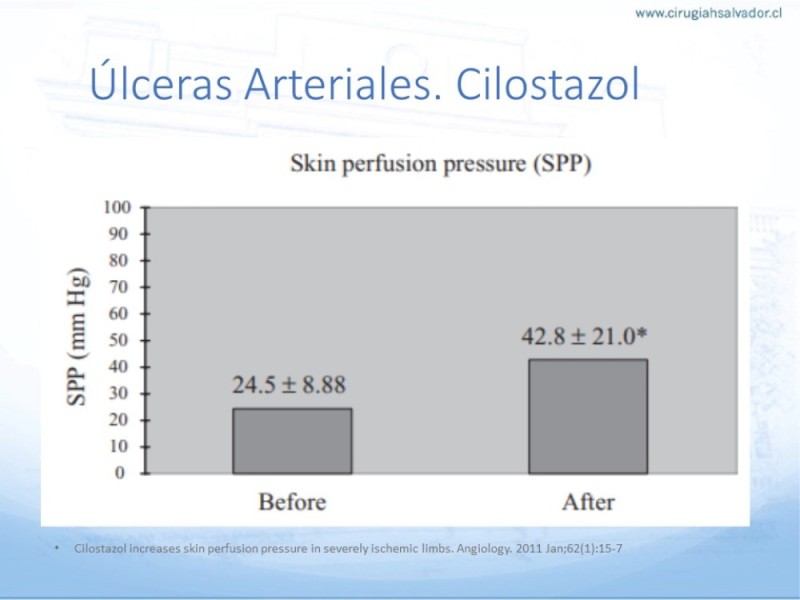 Diapositiva 35 de Enfrentamiento Úlceras EEII