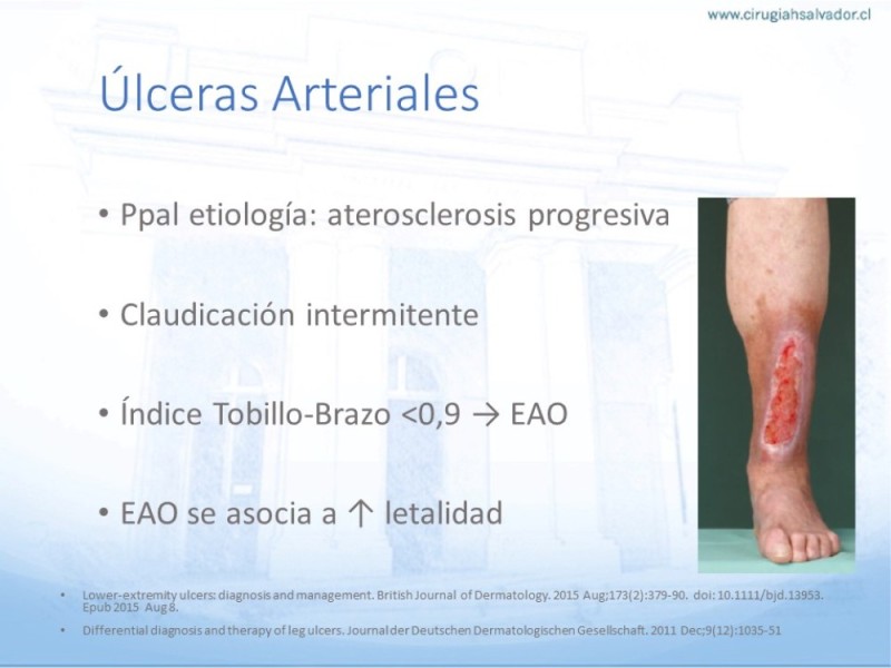 Diapositiva 6 de Enfrentamiento Úlceras EEII